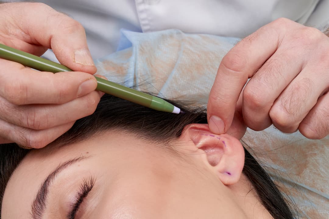 ear surgery preparation with purple pen