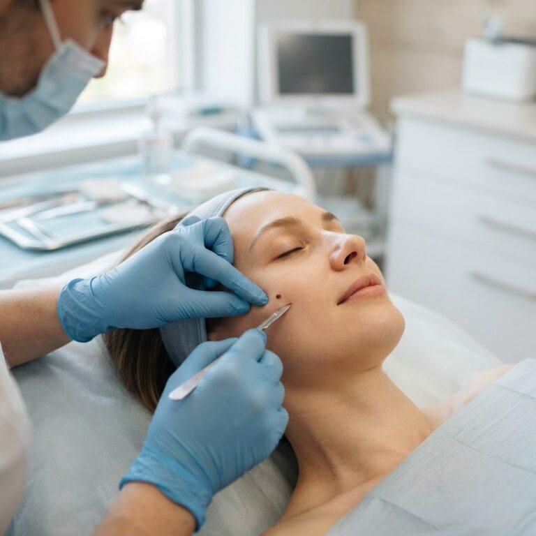 Shave Excision Raised Mole Removal